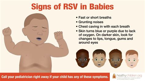 RSV and the flu can be very serious in children. . Can i breastfeed if i have rsv